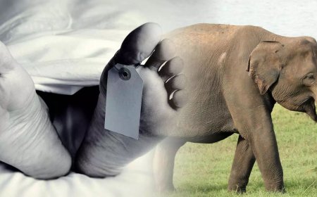 யானை மிதிச்ச ஆளை தூக்கிட்டு வந்தா டாக்டரே இல்லை: வேலுமணி தொகுதியின் வேதனை