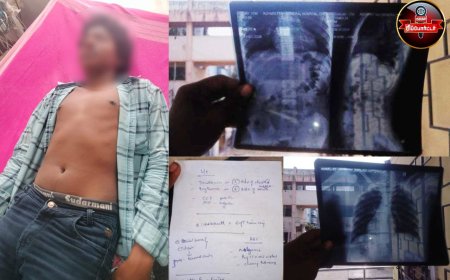 பள்ளி மாணவன் மீது போலீஸ் கொலைவெறி தாக்குதல்..!