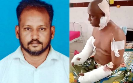மாமுல் தரமறுத்த காண்ட்ராக்டர்... ஆத்திரத்தில் வெட்டிய கஞ்சா போதை ஆசாமிகள்..