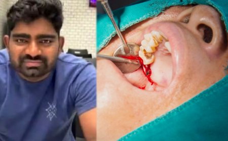 சிரிப்பை அழகாக்க ஆப்ரேஷன்; மணமகன் உயிரிழப்பு - அதிர்ச்சியில் பெற்றோர்....