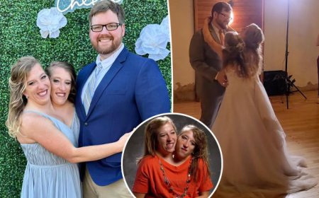 காதலரை கரம்பிடித்தார் அமெரிக்க இரட்டையர் பெண்... 3 ஆண்டுகளுக்குப் பின் திருமண செய்தியை வெளியிட்ட அபி ஹென்செல்...