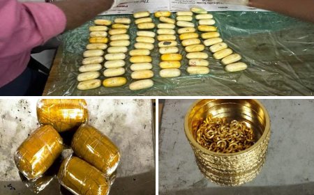 அயன் படத்தையே மிஞ்சிட்டாங்க : வயிற்றில் கொகைன் கடத்தல்