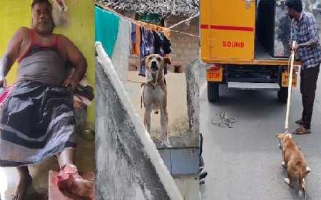 அச்சுறுத்தும் நாய்கள்.. சென்னையில் வளர்ப்பு நாய் கடித்து கணவர் படுகாயம்.. உரிமையாளர் மீது மனைவி புகார்...