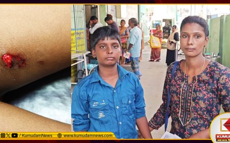 சென்னையில் மீண்டும் கொடூரம் - ரேட்வீலர் நாய் கடித்து 11 வயது சிறுவன் காயம்