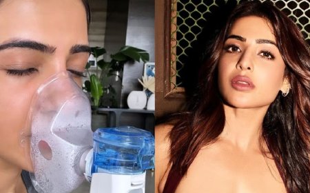 Samantha: சர்ச்சையான மருத்துவ சிகிச்சை அட்வைஸ்... இன்ஸ்டாவில் விளக்கம் கொடுத்த சமந்தா!