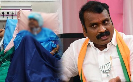 சென்னையில் மருத்துவர் மீது தாக்குதல் - எல்.முருகன், அண்ணாமலை கண்டனம்