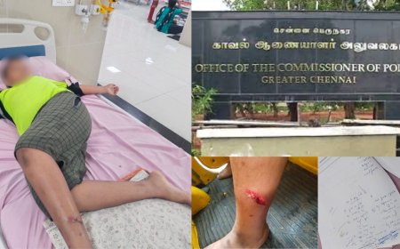 என் பையனை கடிச்ச நாயை ஓளிச்சி வெச்சிட்டாங்க:கமிஷனர் அலுவலகத்தில் தந்தை புகார் 