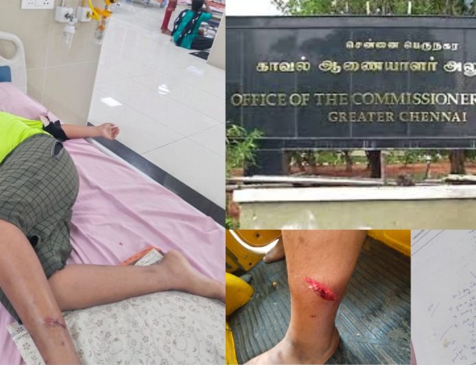என் பையனை கடிச்ச நாயை ஓளிச்சி வெச்சிட்டாங்க:கமிஷனர் அலுவலகத்தில் தந்தை புகார் 