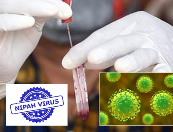 நிபா வைரஸ் எதிரொலி: பதநீர்,கள்ளு,கீழே விழந்த பழங்களை தவிருங்கள்: சுகாதாரத்துறை அறிவுறுத்தல்