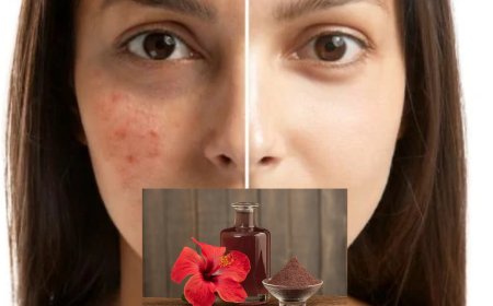 கரும்புள்ளிகள் (Dark spots) போகனுமா? அப்போ இதுதான் சிறந்தது..!